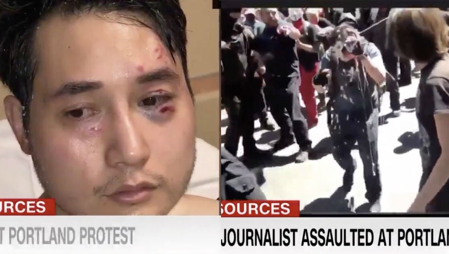 CNN Airs Footage of Antifa Attack on Andy Ngo – But Makes a Glaring Omission